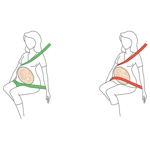 BeSafe Pregnant iZi FIX